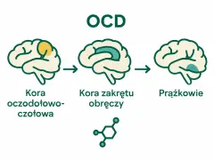 Ilustracja wyjaśnia, ocd co to jest: zmiany w korze mózgowej, w tym kora oczodołowo-czołowa i zakrętu obręczy, oraz obszar prążkowia.